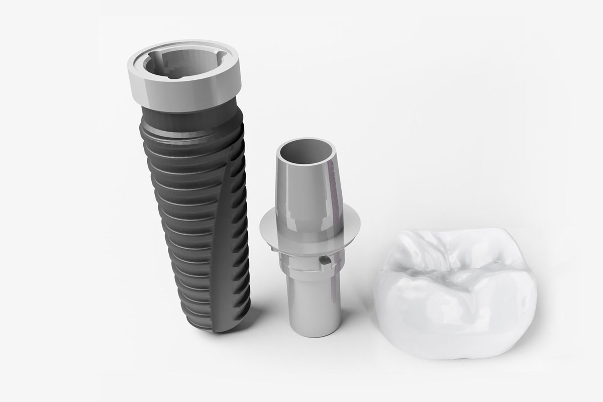 Dental Implants - Kyle, TX