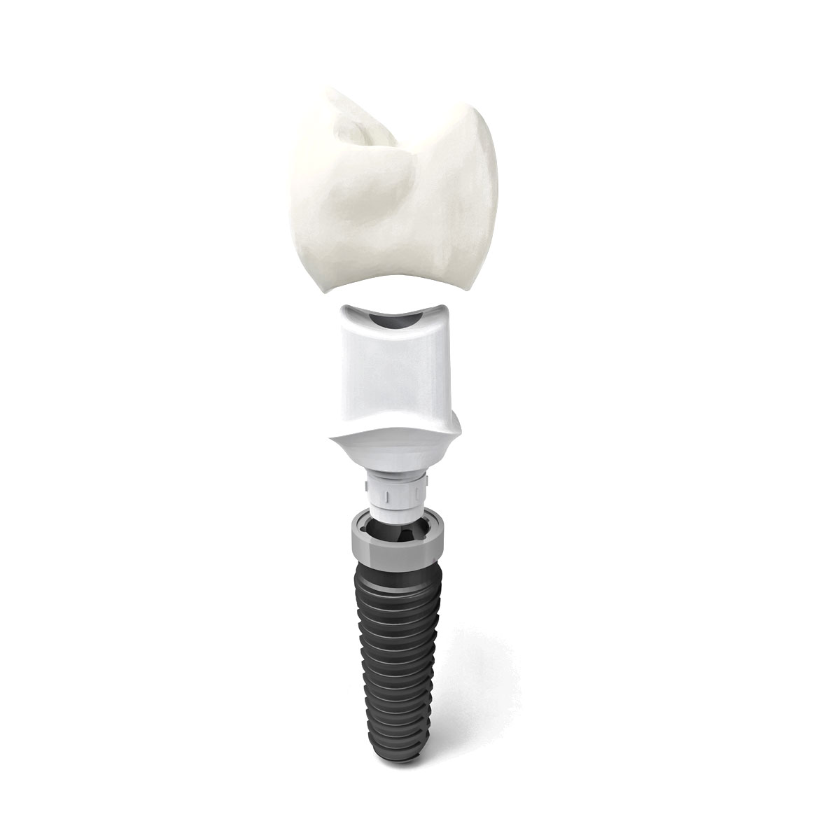 Dental Implants - Kyle, TX